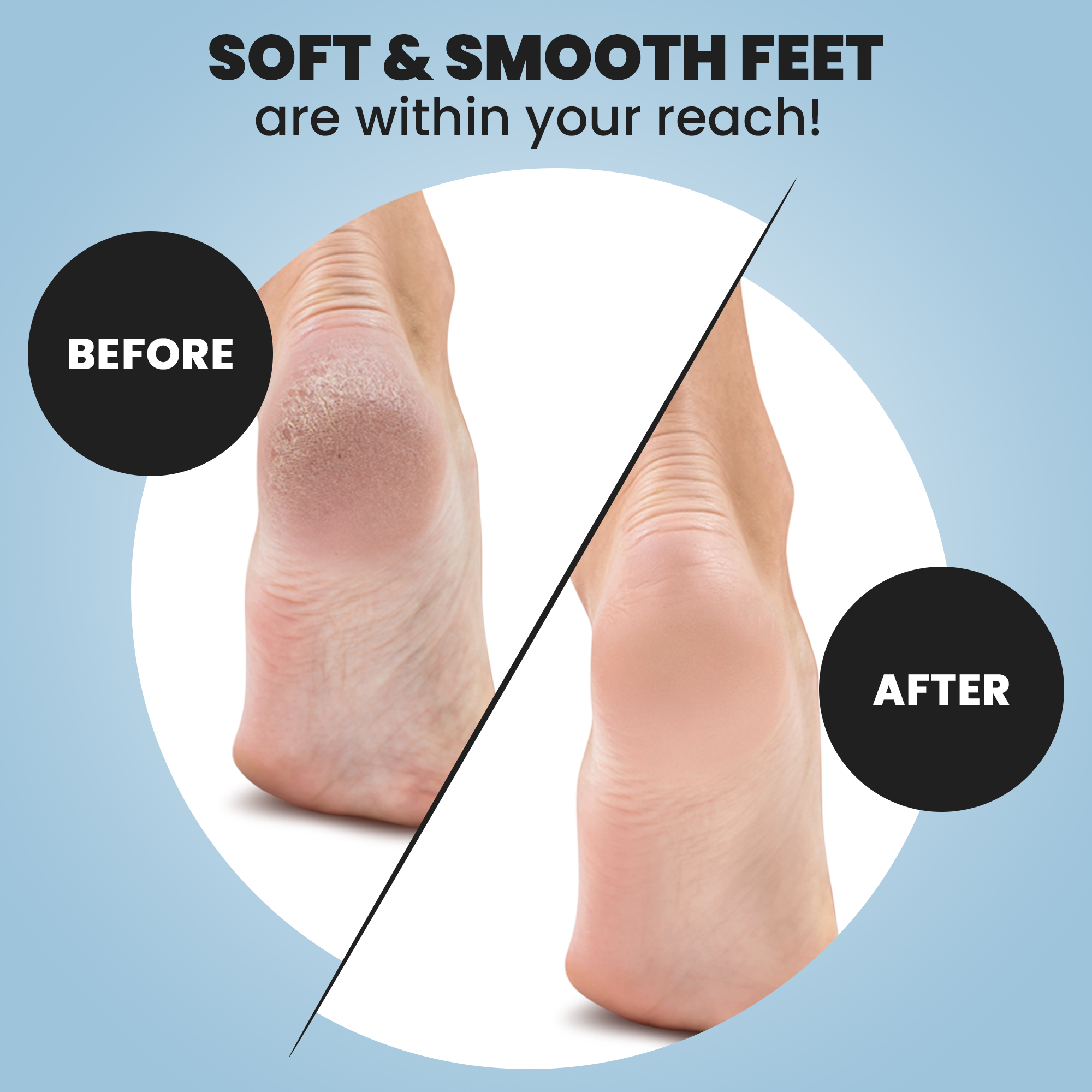 7 Best Ways to Heal Dry, Cracked Heels: Real Solutions That Work